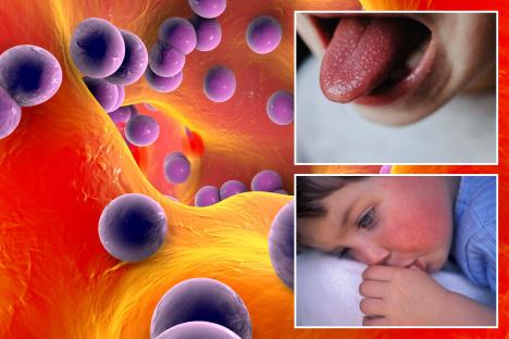 Urgent warning to parents over ‘highly contagious’ Victorian disease with ‘serious’ complications – and 12 signs to spot