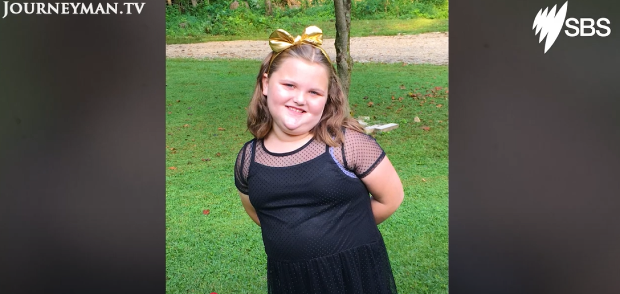 Photo of Lexi, a girl with a genetic condition that causes obesity.