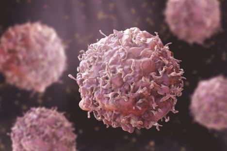 Life-saving early warning system that will give millions faster cancer diagnosis is being rolled out across the NHS