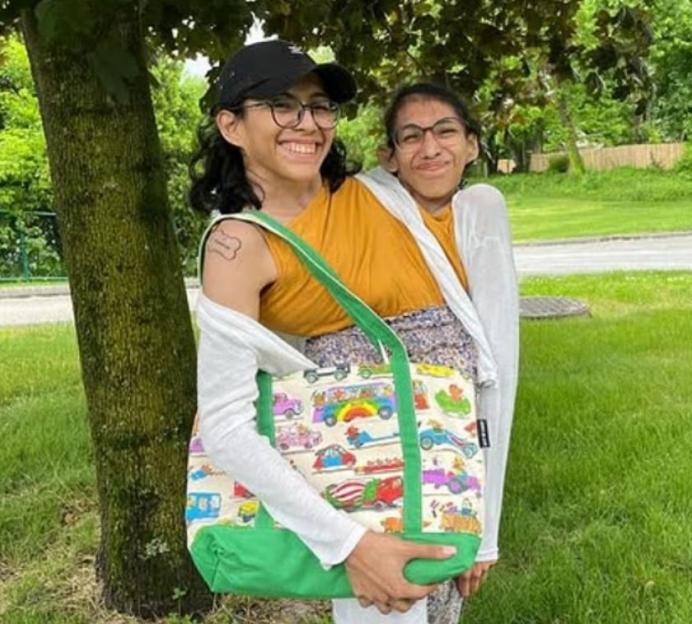 Conjoined twins Carmen and Lupita Andrade smiling outdoors.