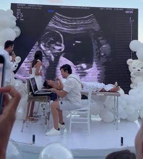 Gender reveal party with large ultrasound image.