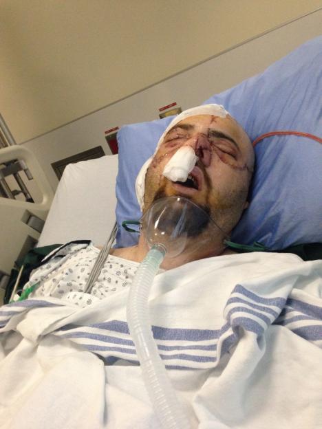 Man in hospital bed with severe facial injuries.
