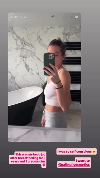 Woman's before-and-after boob job photos.