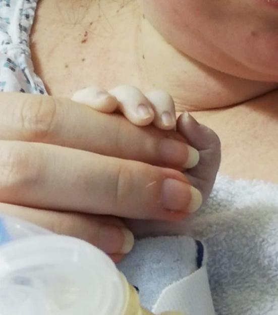 Family's heartbreak after 'miracle baby' died following transfusion delay