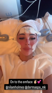 Woman receiving an emface treatment.