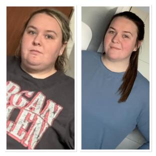 Before and after photos showing a woman's weight loss.
