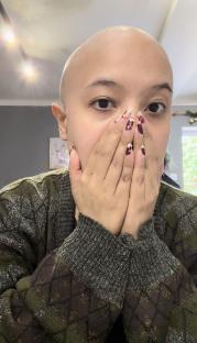 Woman with shaved head covering her face with hands.