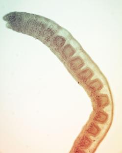 2WTCWCE Schistosoma japonicum is a parasite that causes human schistosomiasis, and is mainly prevalent in Asia.