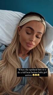 Woman in hospital bed after receiving epidural.