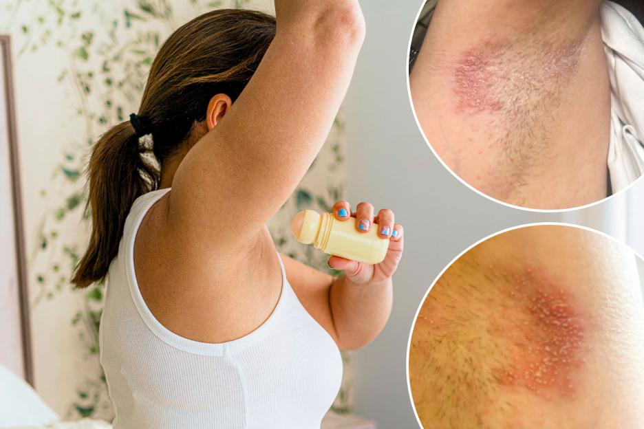 Shoppers Alarmed as More Roll-On Deodorants Pulled from UK Shelves Due to 'Burning Armpits' Reaction