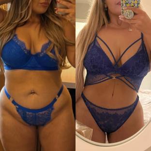 Before and after photos of a woman in blue lingerie following body surgery.