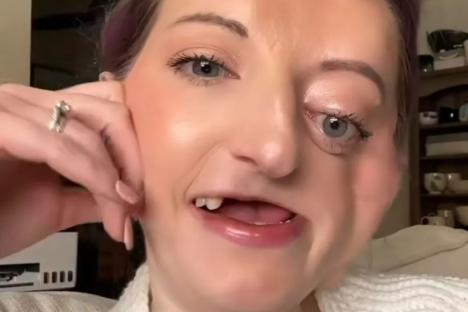 Doctors blamed Nicola’s ‘nagging toothache’ on a sinus infection – it stole her smile, half her face and her life
