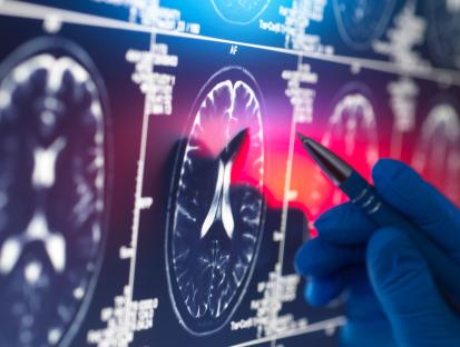 Breakthrough dementia drugs rejected AGAIN for use on NHS – as experts blast it ‘can’t keep up with science’