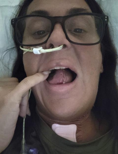 I was forced to have half my tongue chopped off and rebuilt with my ARM after doctors dismissed ‘ulcer’ for years