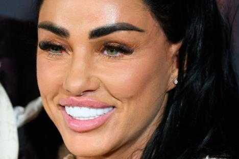 From rotting gums to bad breath – the seven side effects of ‘Turkey Teeth’ that could cost you £15K to fix 