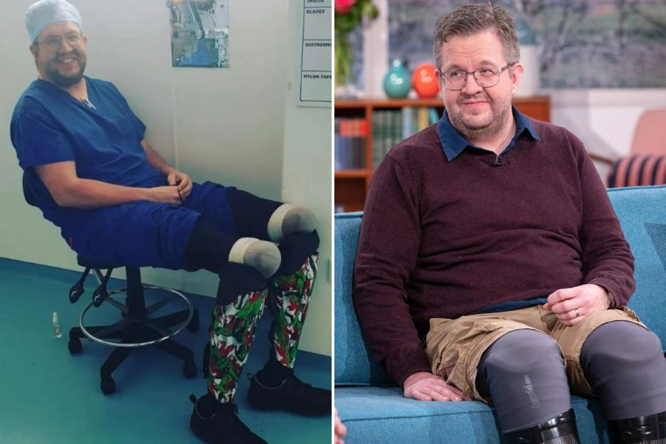 Surgeon who claimed on TV he lost legs to sepsis pleads GUILTY to causing own injuries