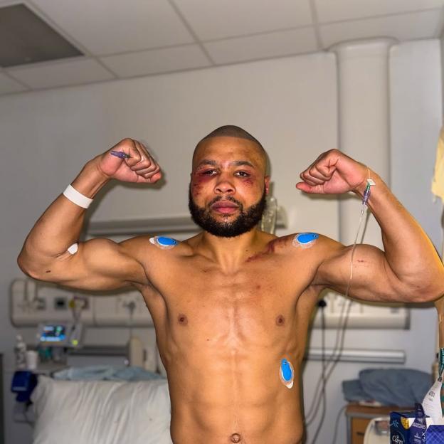 Chris Eubank Jr. flexing in a hospital gown, with bruises on his face and medical sensors on his chest and arms.