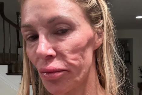 Celebrity Big Brother star looks unrecognisable with swollen face after losing FIVE teeth in shock health battle