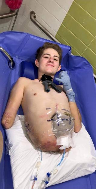 Man, 25, who lost entire lower body after being chopped in half in forklift accident reveals new devastating blow