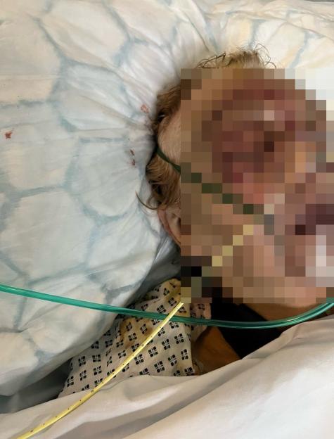 A bloodied, injured woman in a hospital bed.