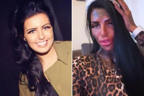 I used to look like a typical girl next door but now trolls call me ‘Poundland Katie Price’ because of my mega lips