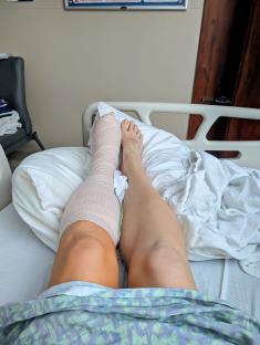 Bandaged foot in a hospital bed.