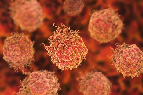 3D illustration of prostate cancer cells.
