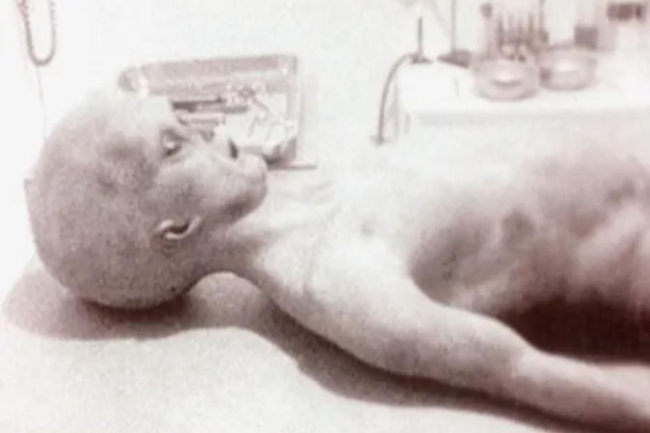 Was infamous Alien Autopsy actually REAL? New ‘bonkers’ Louis Theroux-produced documentary attempts to find out