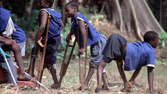 17 cases of poliovirus variant recorded 15 LGAs – NPHCDA