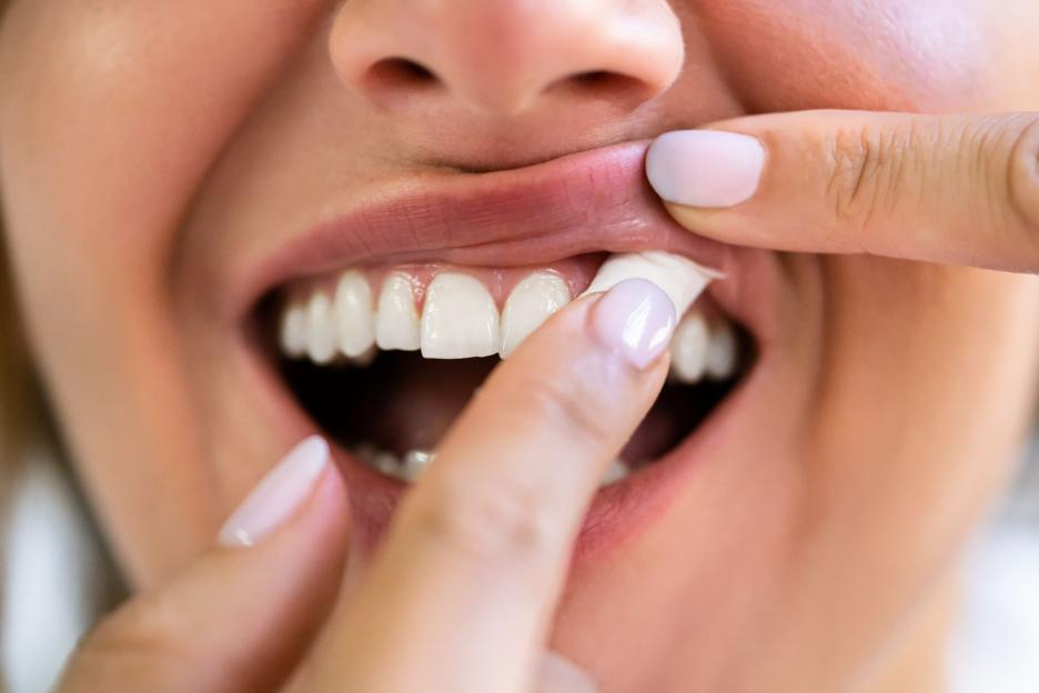 Snus nicotine pouches trigger NEW gum problem – stop immediately if you spot warning sign, says dentist