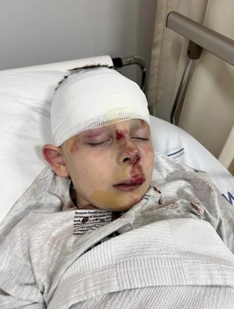 Injured boy in hospital bed.