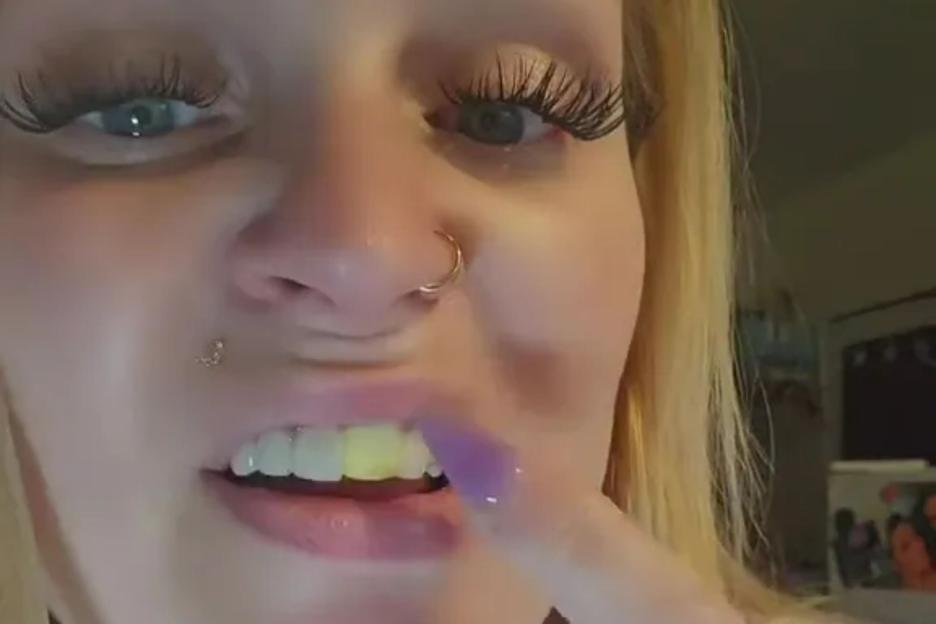 I make my own gnashers to fill the gaps in… it does turn yellow but I don’t want to fork out £5k for a new smile