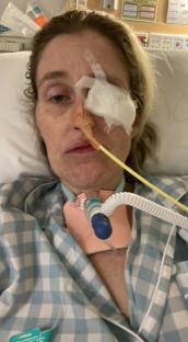 Woman in hospital bed with medical tubes.