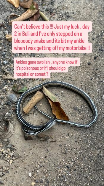 Love Island star rushed to hospital after being bitten by a poisonous snake