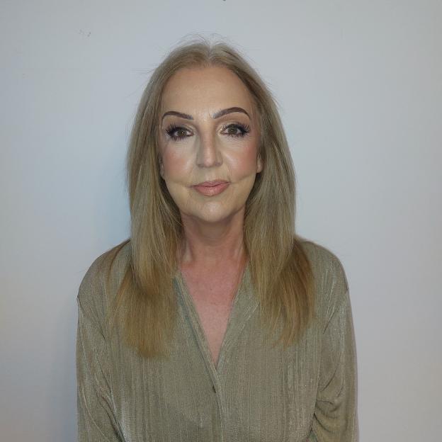 Dot Marr smiling at the camera after undergoing an eye bag operation.