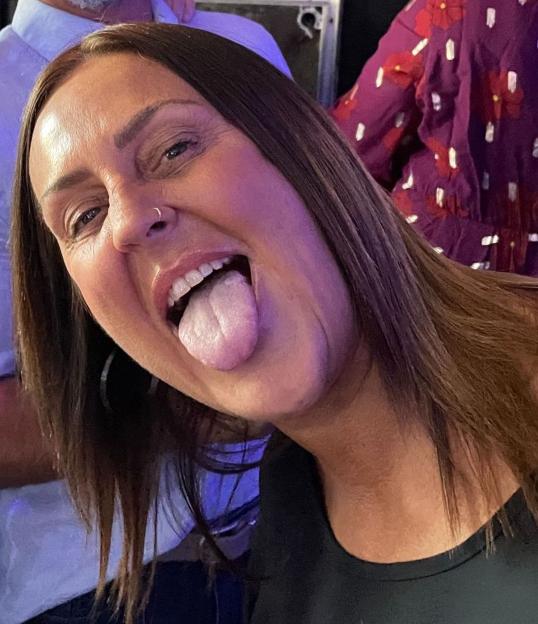Close-up photo of a woman sticking out her tongue, showing a discoloration.