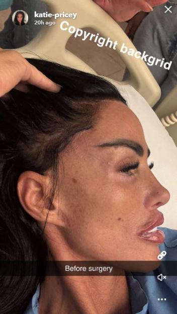 Katie Price before surgery.