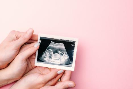 Couple holding ultrasound image of their baby.