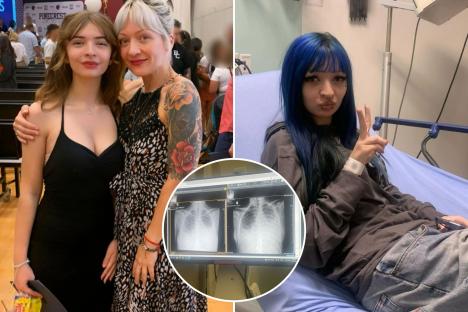 Girl, 15, ‘hours from death’ with a LITRE of liquid trapped in her lung after vaping ‘to impress her boyfriend’