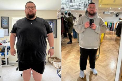 I lost 10.5st in 8 months on fat jabs but suffered 3 side effects – I wasn’t prepared for how fast it happened