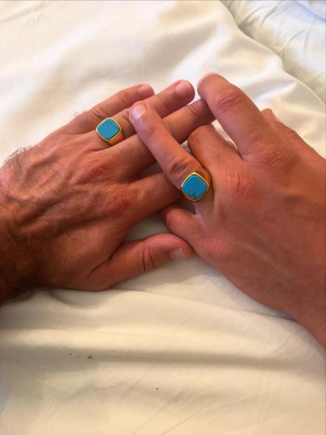 Two hands displaying gold rings with turquoise stones.