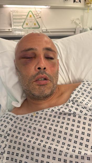 Shocking moment dad was hit by E-bike leaving him "hours from death"