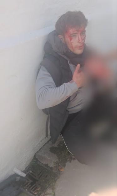 Bloodied man sitting against a wall.