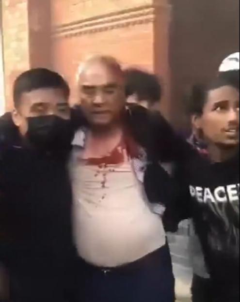 A bloody man being supported by two people.