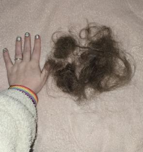 A woman's hand next to a clump of hair that fell out.