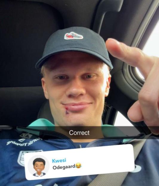 Haaland shows a cut lip while answering fan questions.