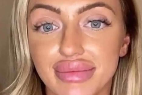 See the pictures that leave people gobsmacked woman is the same person after ditching fillers for the ultimate glow down