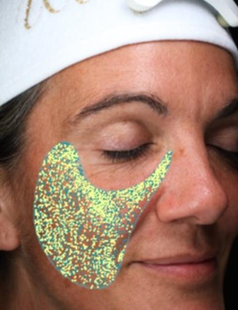 Skin analysis showing spots, wrinkles, texture, pores, UV spots, brown spots, red areas, and porphyrins; actual age 46, TruSkin Age 53.