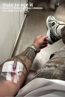 Person with an IV in their arm in a hospital.