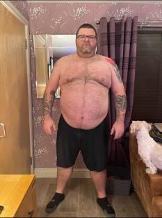 Photo of a shirtless man before weight loss.